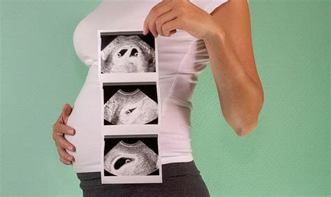 бременност 40 седмици защо хемороидите излизат силно